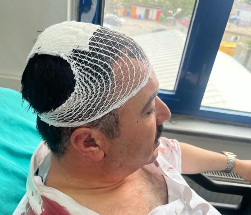 Kahramanmaraş’ta Belediye Başkan Yardımcısına Makamında Saldırı! Siyasi Ziyaret Skandala Dönüştü