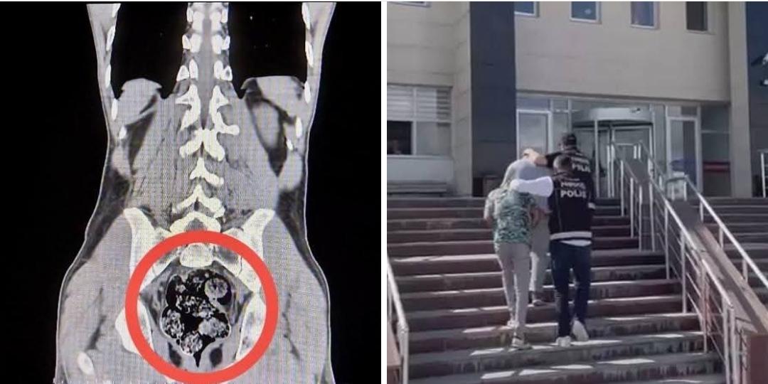 Kars’ta Uluslararası Uyuşturucu Operasyonu: 2 İran Uyruklu Kurye Tutuklandı